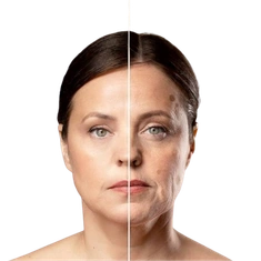 Wrinkle Reduction