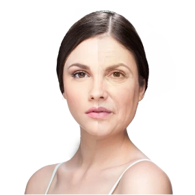 Anti-Aging