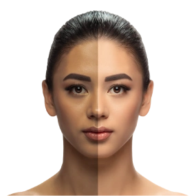 Wrinkle Reduction