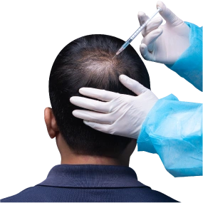 PRP Therapy